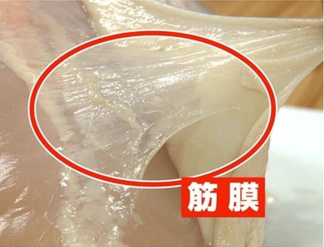 筋膜切開術の合併症とリスク